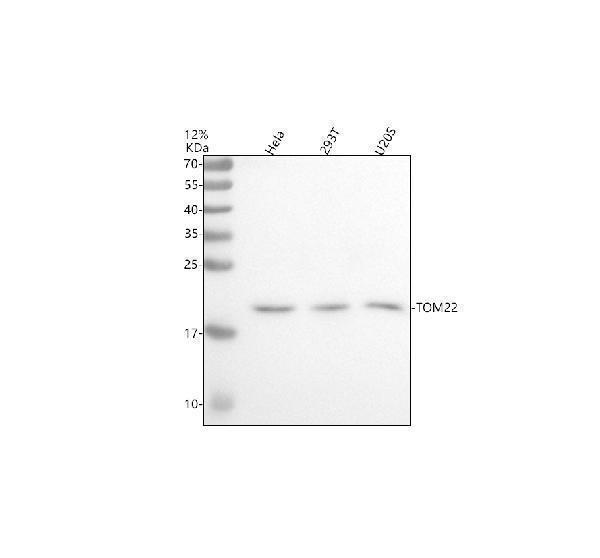 Western blot analysis of TOM22/TOMM22 using anti-TOM22/TOMM22 antibody (A08668-1)