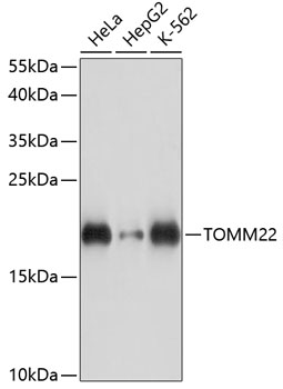 Western blot analysis of extracts of various cell lines, using TOMM22 antibody  at 1:3000 dilution