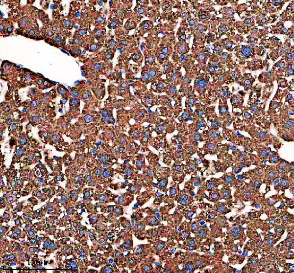 IHC analysis of HOGA1 using anti-HOGA1 antibody (A08669)
