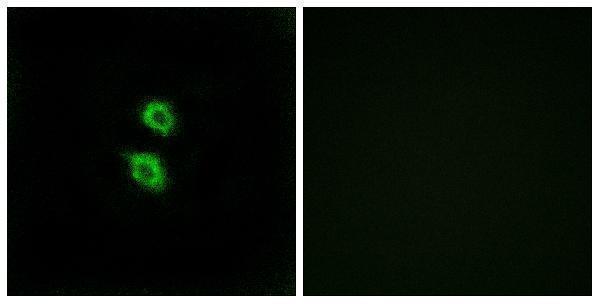 Immunofluorescence analysis of MCF7 cells, using ARSD Antibody