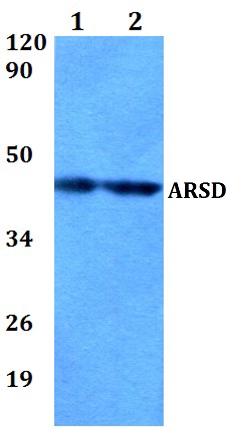 Western blot (WB) analysis of ARSD polyclonal antibody at 1:500 dilution
Lane1:MCF-7 whole cell lysate
Lane2:sp2/0 whole cell lysate 
