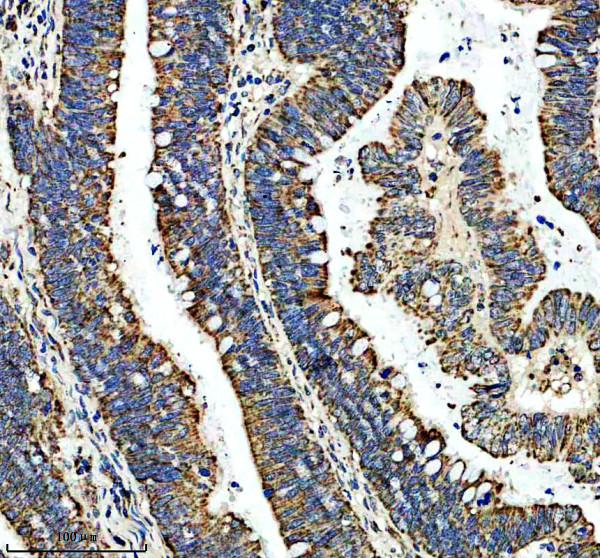 a08674 2 gtpbp3 primary antibodies ihc testing 1