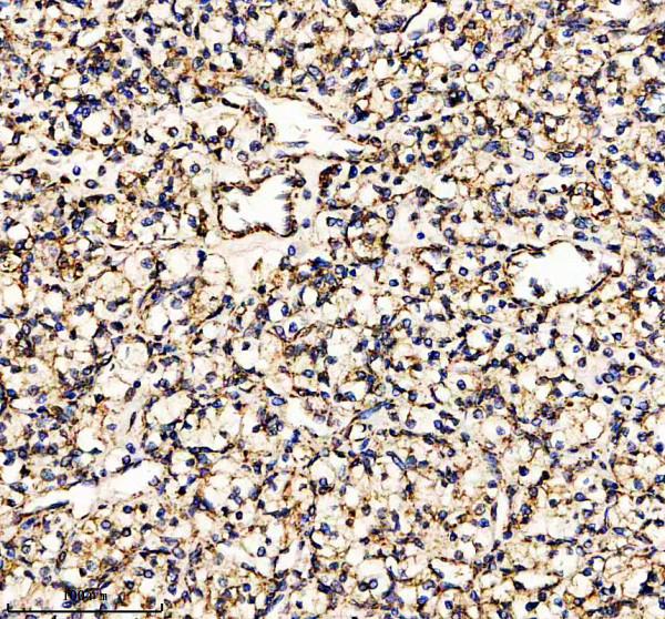a08674 2 gtpbp3 primary antibodies ihc testing 2