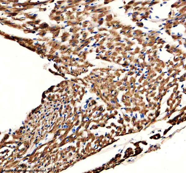 a08674 2 gtpbp3 primary antibodies ihc testing 3