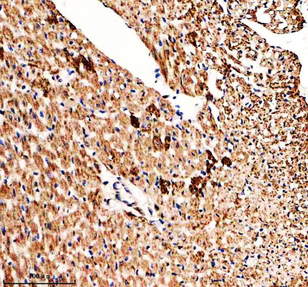 a08674 2 gtpbp3 primary antibodies ihc testing 4
