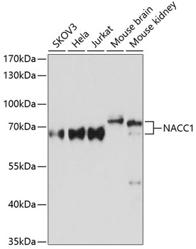 a08675 1 nacc1 primary antiboties wb testing 1