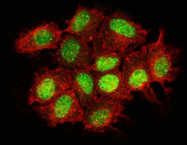 a08675 3 nacc1 primary antibodies if testing 5