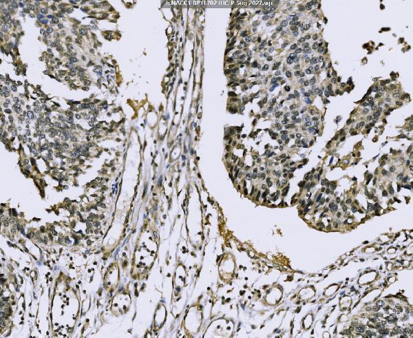  IHC analysis of Nac1/NACC1 using anti-Nac1/NACC1 antibody (A08675-3)