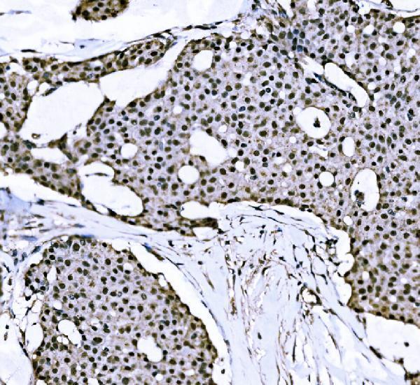  IHC analysis of Nac1/NACC1 using anti-Nac1/NACC1 antibody (A08675-3)