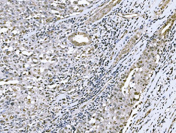 a08675 3 nacc1 primary antibodies ihc testing 4