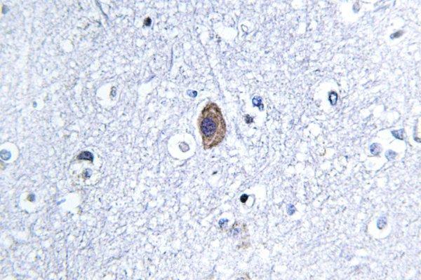 a08680 1 cnn2 primary antiboties ihc testing 2