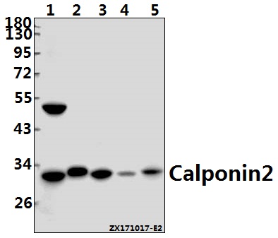 a08680 1 cnn2 primary antiboties wb testing 1