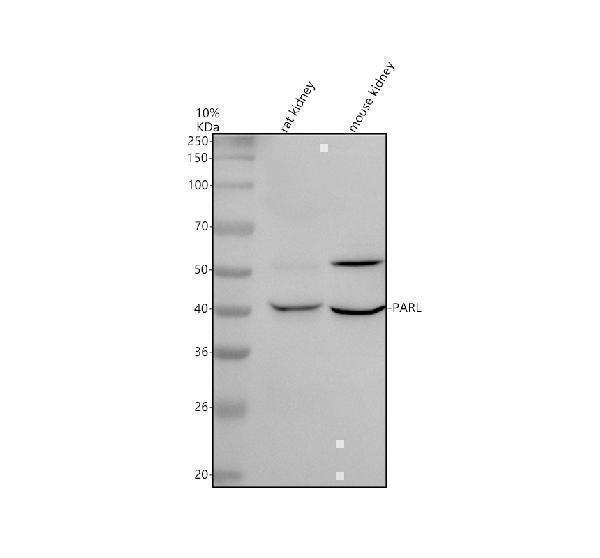 Western blot analysis of PARL using anti-PARL antibody (A08686-1)