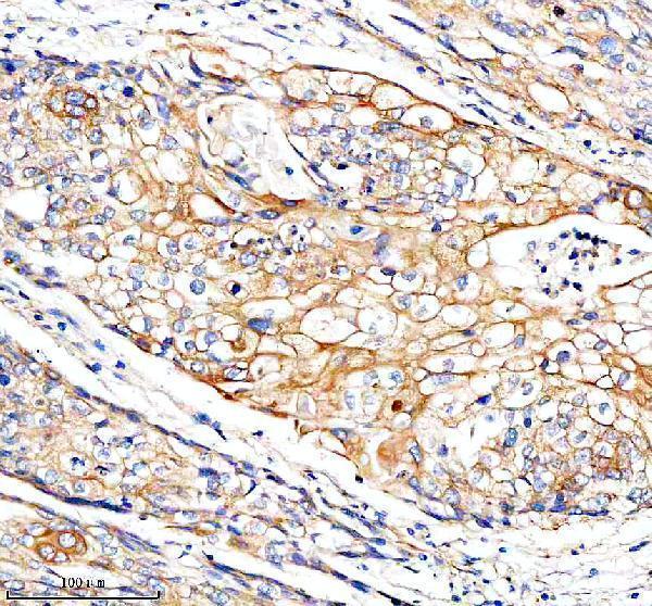a08688 2 fundc1 primary antibodies ihc testing 2
