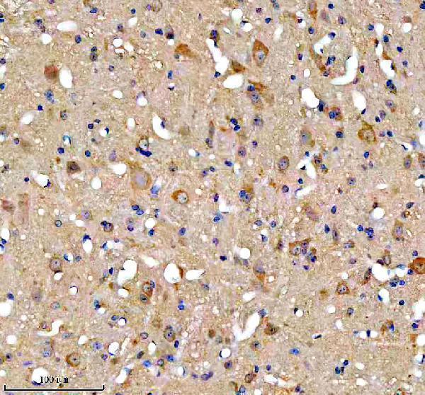 a08688 2 fundc1 primary antibodies ihc testing 3