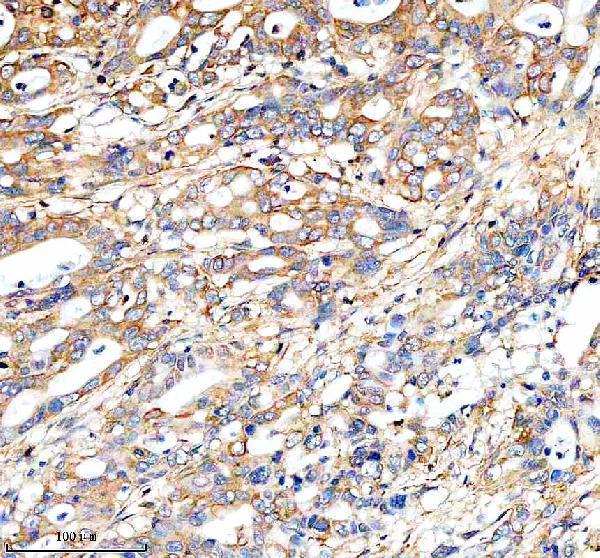 a08688 2 fundc1 primary antibodies ihc testing 4