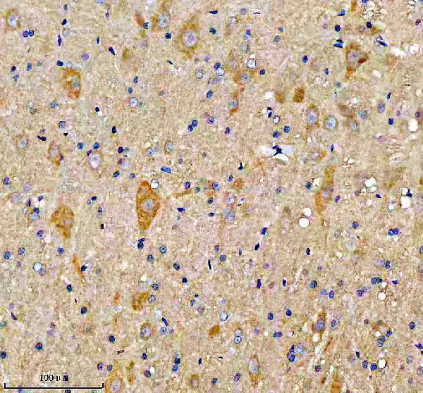 a08688 2 fundc1 primary antibodies ihc testing 5