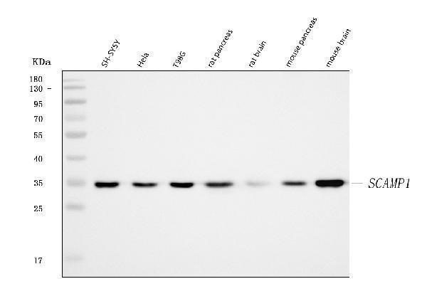  Western blot analysis of SCAMP1 using anti-SCAMP1 antibody (A08692-1)