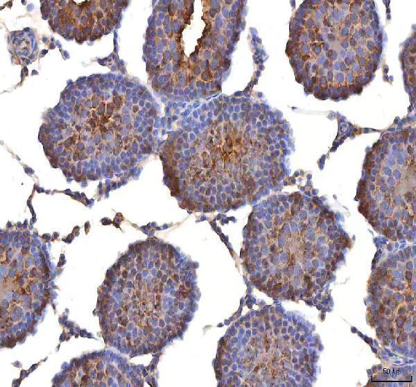 a08693 1 isyna1 primary antibodies ihc testing 10
