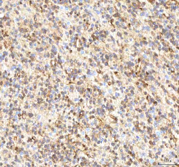  IHC analysis of ISYNA1 using anti-ISYNA1 antibody (A08693-1)
