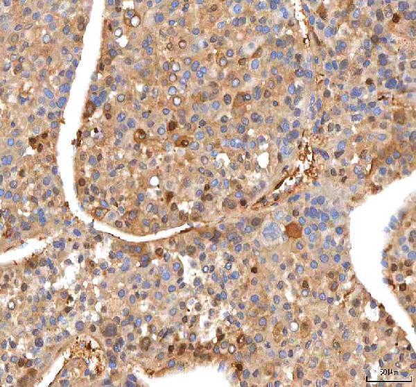  IHC analysis of ISYNA1 using anti-ISYNA1 antibody (A08693-1)