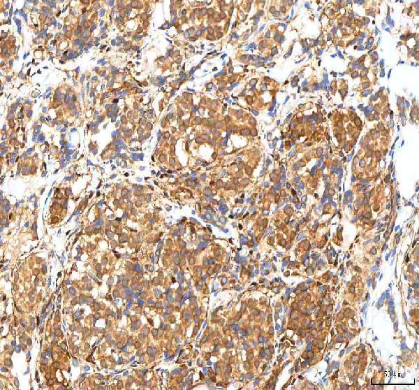 a08693 1 isyna1 primary antibodies ihc testing 4