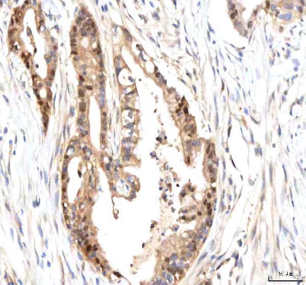 a08693 1 isyna1 primary antibodies ihc testing 5