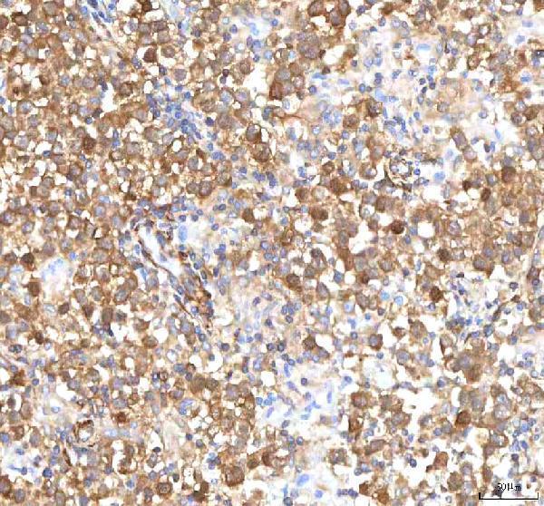a08693 1 isyna1 primary antibodies ihc testing 7