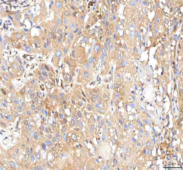 a08693 1 isyna1 primary antibodies ihc testing 8