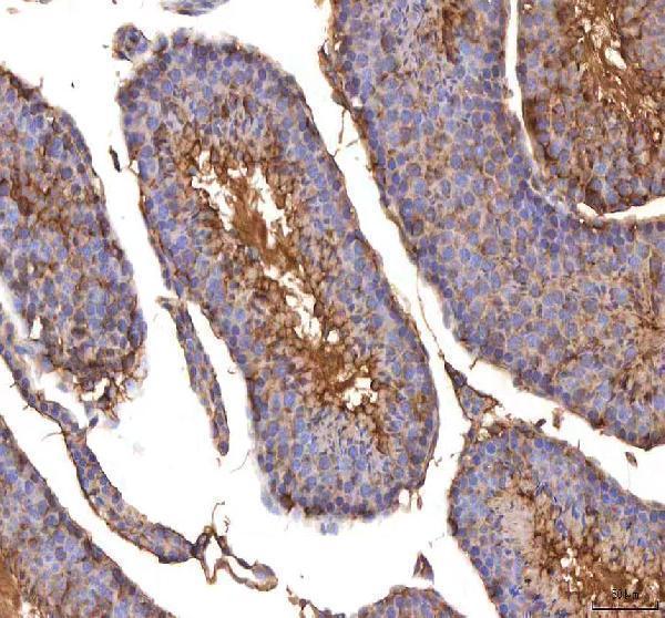 a08693 1 isyna1 primary antibodies ihc testing 9