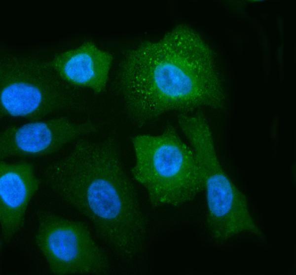 a08694 1 poc1a primary antibodies if testing 6