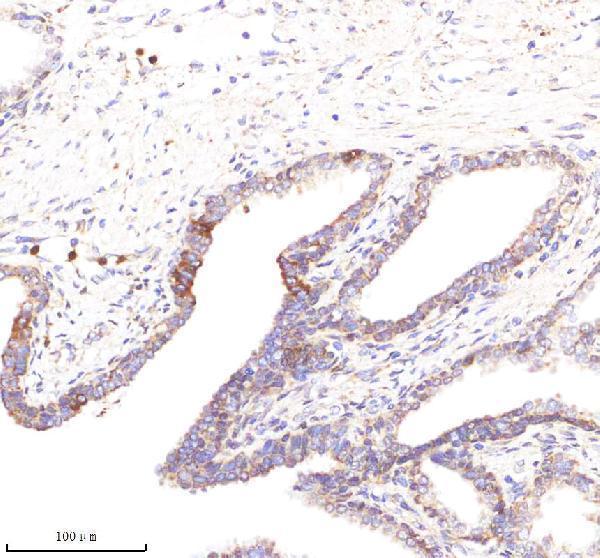 a08694 1 poc1a primary antibodies ihc testing 2