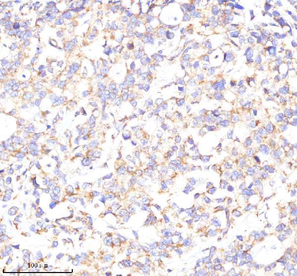 a08694 1 poc1a primary antibodies ihc testing 3