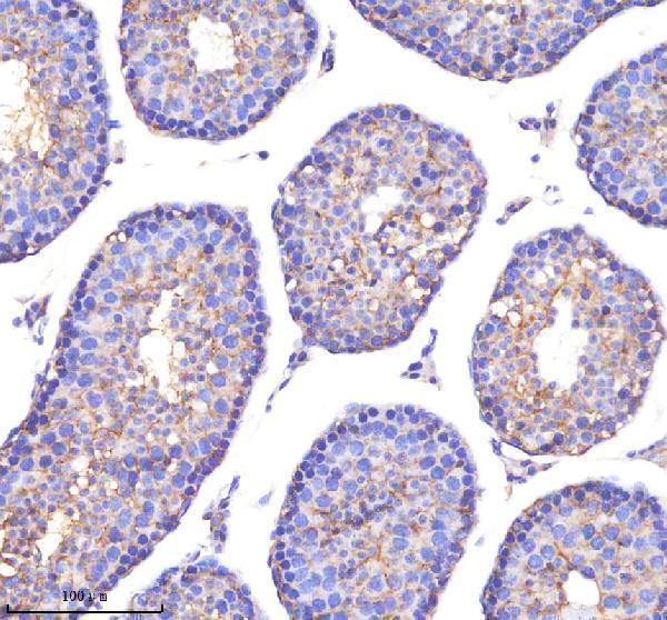 a08694 1 poc1a primary antibodies ihc testing 4