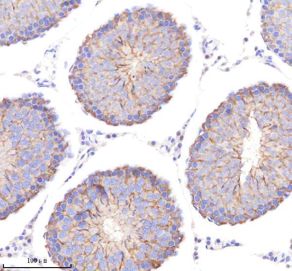 a08694 1 poc1a primary antibodies ihc testing 5