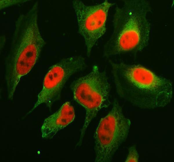 a08695 2 fubp3 primary antibodies if testing 1