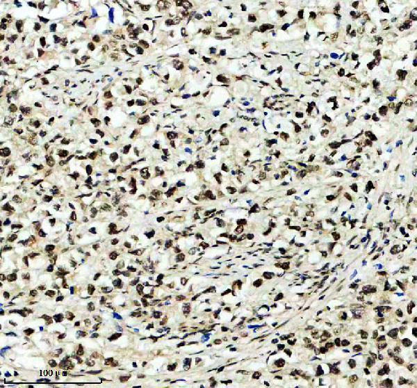 a08695 2 fubp3 primary antibodies ihc testing 1