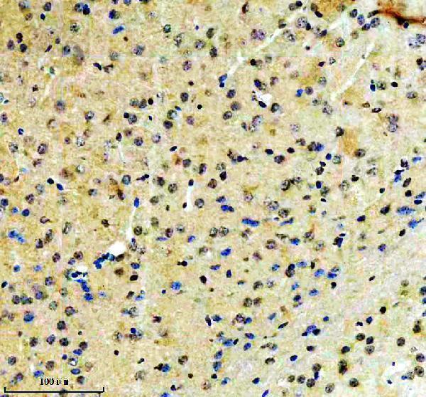 a08695 2 fubp3 primary antibodies ihc testing 2