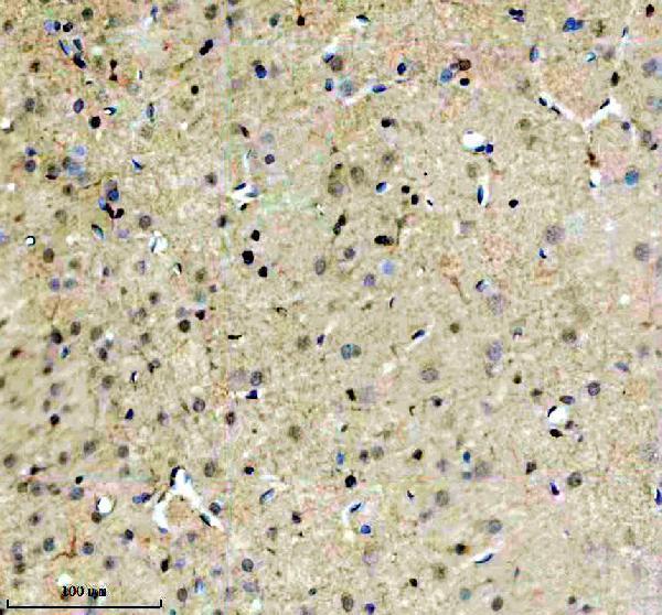 a08695 2 fubp3 primary antibodies ihc testing 3