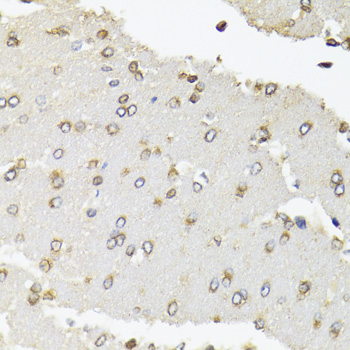 Immunohistochemistry of paraffin-embedded rat brain using POLR2B antibody  at dilution of 1:100 