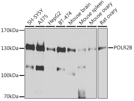 Western blot analysis of extracts of various cell lines, using POLR2B antibody  at 1:1000 dilution