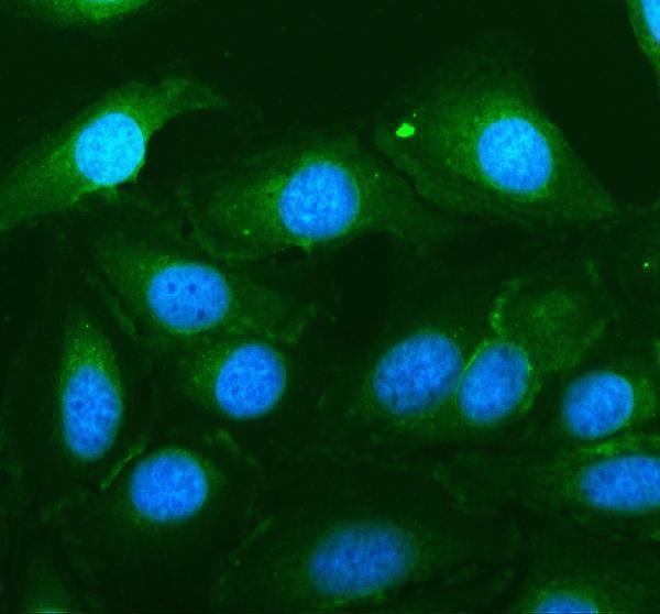 IF analysis of CALCOCO1 using anti-CALCOCO1 antibody (A08702-1)