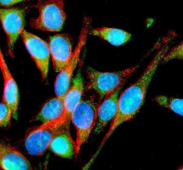IF analysis of IMMP2L using anti-IMMP2L antibody (A08704-1) and anti-Beta Tubulin antibody (M01857-3)