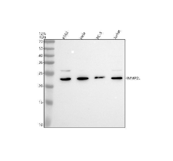 Western blot analysis of IMMP2L using anti-IMMP2L antibody (A08704-1)