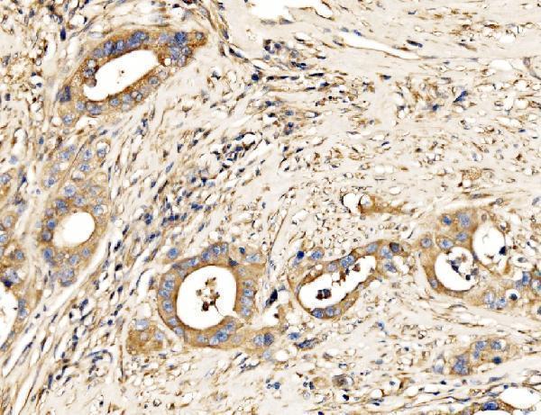  IHC analysis of MLX-interacting protein/MLXIP using anti-MLX-interacting protein/MLXIP antibody (A08709-2)
