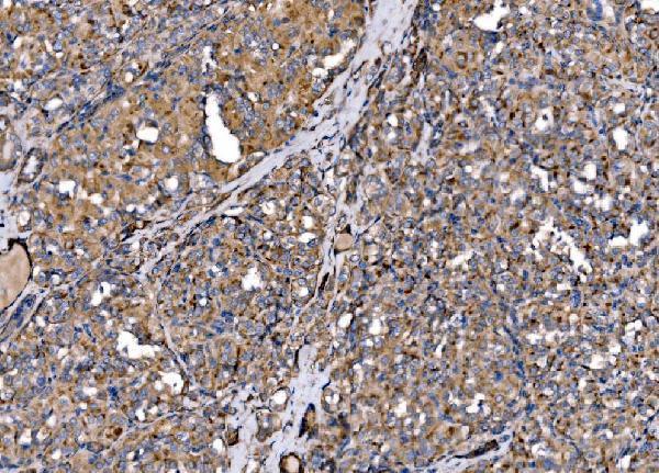 a08709 2 mlxip primary antibodies ihc testing 4