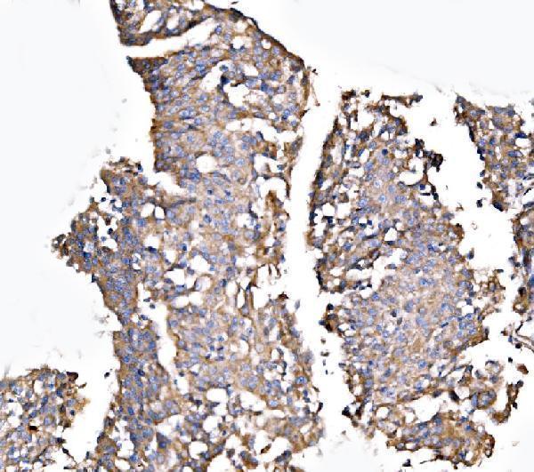 a08709 2 mlxip primary antibodies ihc testing 5