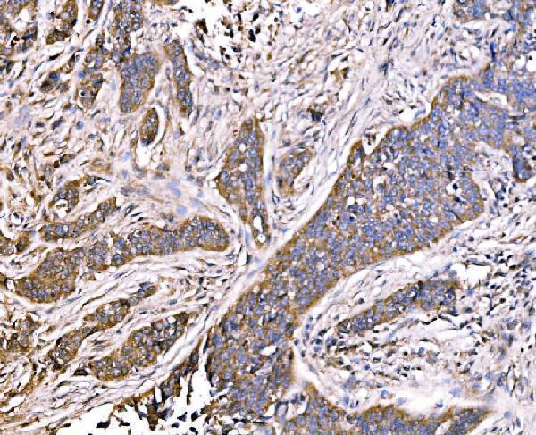 a08709 2 mlxip primary antibodies ihc testing 6