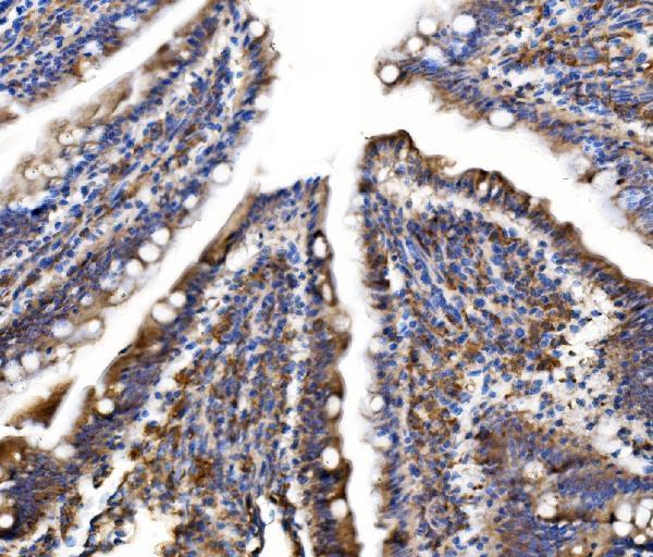 a08709 2 mlxip primary antibodies ihc testing 7