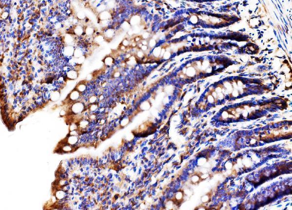 a08709 2 mlxip primary antibodies ihc testing 8